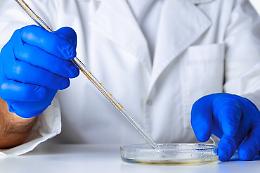 Casi di vaiolo delle scimmie dalla Lombardia alla Sicilia: due migranti i casi sospetti nell'isola