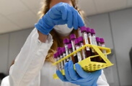 Covid, il bollettino del 1 ottobre: in Sicilia altri 1.188 casi, un morto e ricoveri in salita