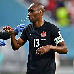 Il capitano del Canada Atiba&nbsp;Hutchinson con un tampax nel naso per fermare un'emorragia
