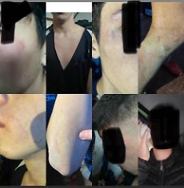 Botte da orbi in una partita di calcio under 17 nel Palermitano, intervengono anche i genitori: «Violenza inaudita»