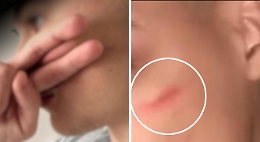 Sfida della “cicatrice francese”, l'Antistrust indaga su TikTok: sott'accusa l'algoritmo