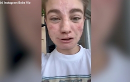 Bebe Vio, l'appello ai ladri dopo il furto della borsa: "Ridatemi la tesi"&nbsp;