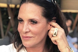 Il suo cane azzanna manager di un resort di Briatore, avvocatessa fermata in Kenya