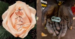 Il dramma delle donne immigrate: anche in Sicilia tanti casi di infibulazione