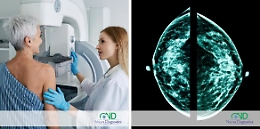 La Diagnostica: un alleato fondamentale nella lotta contro il tumore al seno