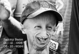 Sammy Basso, cos'&egrave; la progeria: i sintomi che la caratterizzano