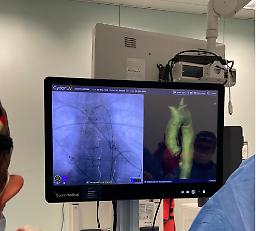 Policlinico di Palermo, eseguiti tre interventi di riparazione di aneurisma dell’aorta con l'intelligenza artificiale