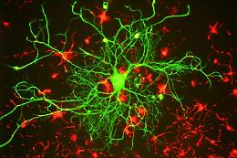 Lo studio dell'istituto di Cristallografia di Catania sulla molecola smart contro l'Alzheimer, aiuta le difese naturali