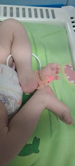 Piccolo guerriero torna a casa: il bimbo prematuro operato al cuore &egrave; fuori pericolo