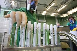 Virus aviaria in Lombardia: paziente rientrato dall'Africa resta caso isolato