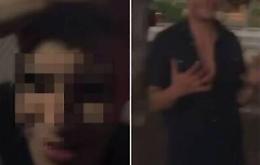 Video choc dopo l&rsquo;incidente a Ceriale, nuovo messaggio social del giovane: &laquo;Siete fortunati, altrimenti vi sparo&raquo;