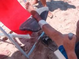 Turisti morsi in mare da pesci a Palinuro con copiose perdite di sangue: due le specie sott'accusa