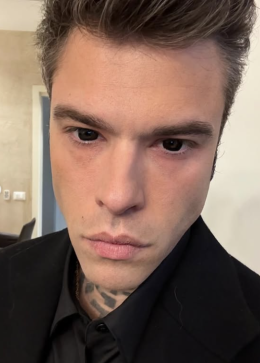 Fedez torna sui social dopo il ricovero: "Mi devo fermare. Il tempo &egrave; l'unico bene prezioso"