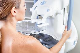 Screening mammografico a Catania e provincia, tutti gli appuntamenti dell'Asp ad agosto e settembre