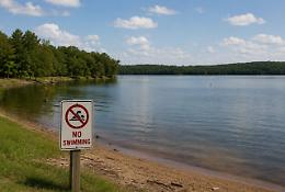 Dramma al lago in Louisiana: muore una bambina di otto anni per l&rsquo;ameba mangia-cervello