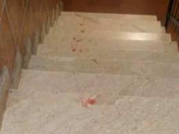 Catania, il &ldquo;bullo&rdquo; gambizzato per 40 euro. Il movente shock: &laquo;Lo ha educato&raquo;