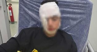 Ragazzino pestato da una baby gang in piazza Stesicoro a Catania: padre posta la foto e scatta l'appello per pi&ugrave; sicurezza