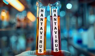 In Italia scatta allerta per l'Hantavirus: sorveglianza attiva in quattro regioni