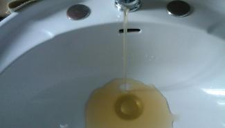 Acqua gialla e rubinetti a secco a Erice: residenti di Raganzili, San Giuliano e Pizzolungo chiedono interventi urgenti