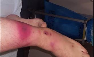 Il mare dello Stretto di Messina &egrave; super vigilato, c'&egrave; la presenza di un batterio che ha fatto gi&agrave; registrare vittime