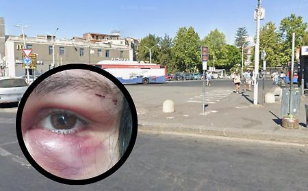 Catania, il racconto di una 17enne: &laquo;Prima gli insulti omofobi poi un cazzotto in faccia&raquo;
