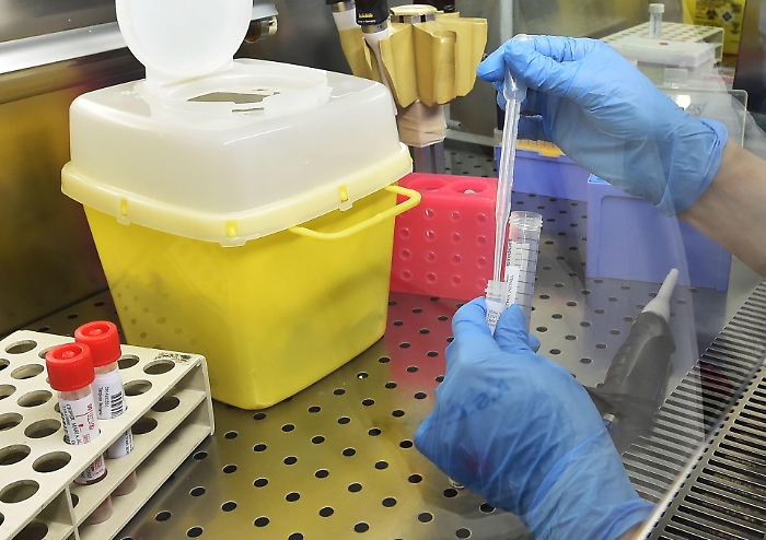 Coronavirus, infettivologo siciliano: «Stupisce assenza di test salivare»