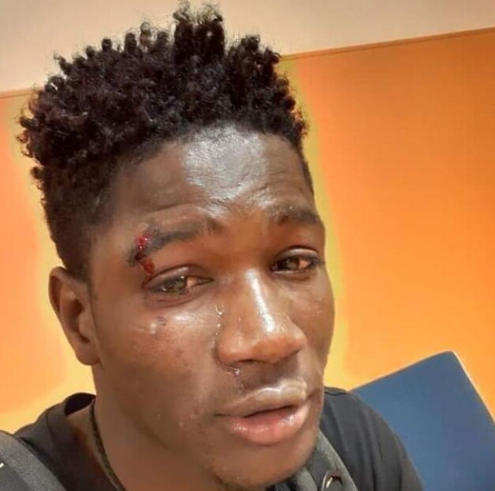 Aggressione razzista Palermo, gli indagati salgono a nove