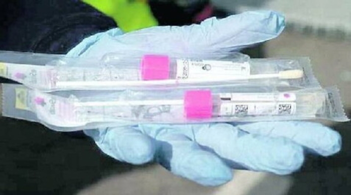 Coronavirus, risolto "giallo" dei tamponi per positività docente di Agraria