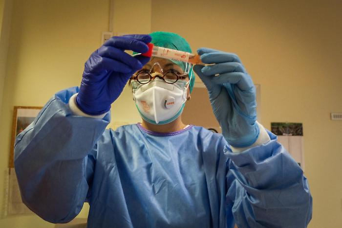 Coronavirus, paziente curato con farmaco per l'artrite sta migliorando