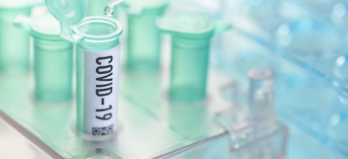 Al via un concorso letterario sulla pandemia