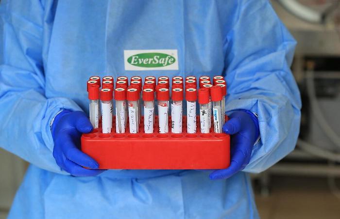 Covid, il bollettino del 25 gennaio: in Sicilia 885 nuovi casi e 34 morti