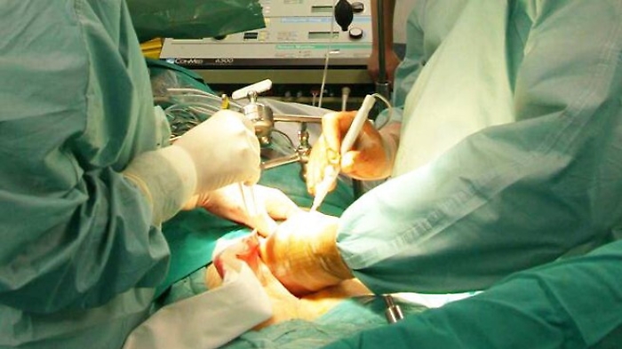 Palermo, tre malati salvi con organi donati da 47enne