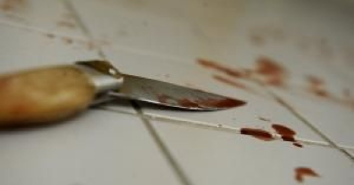 Catania: si lamentano dei rumori, la vicina risponde con una coltellata