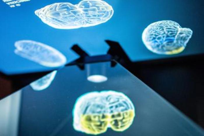 Scoperto Hub della memoria, chiave per recupero post-ictus