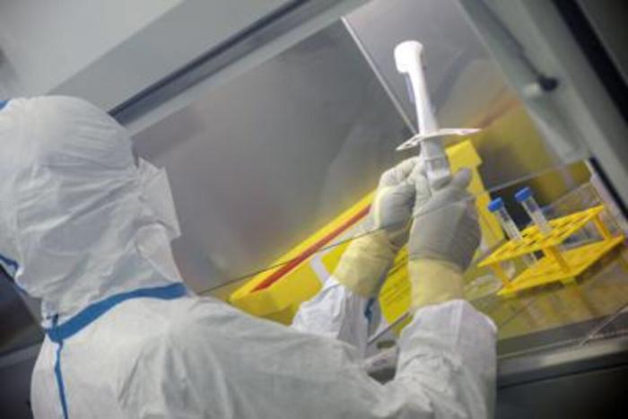 Covid, &laquo;monoclonali inefficaci nelle infezioni severe&raquo;: ecco lo studio dell'Universit&agrave; di Catania