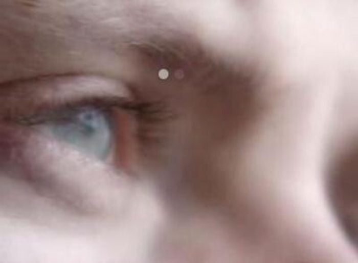 Pediatria: teenager a rischio suicidio, accessi Bambino Ges&ugrave; aumentati 20 volte