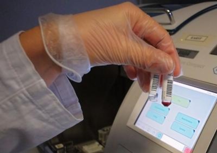 Diabete, in crescita in tutta Europa e in Sicilia i livelli sono sopra la media