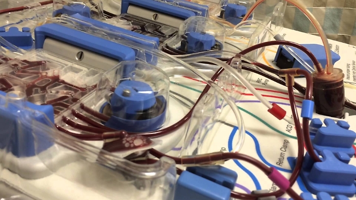 Coronavirus, nel lavaggio del sangue un nuovo “alleato”