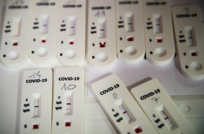 Coronavirus, in Sicilia oltre 200 laboratori privati pronti per i test sierologici