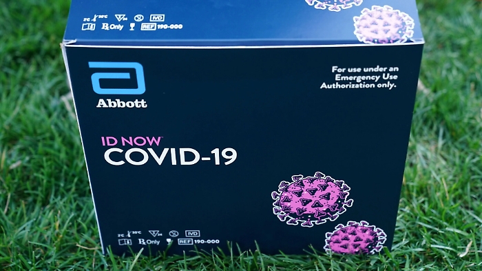 Come funziona il test sierologico approvato in Italia, ma non darà la “patente di immunità”