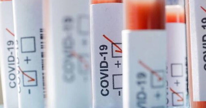 Coronavirus, in provincia di Agrigento aumentano i guariti