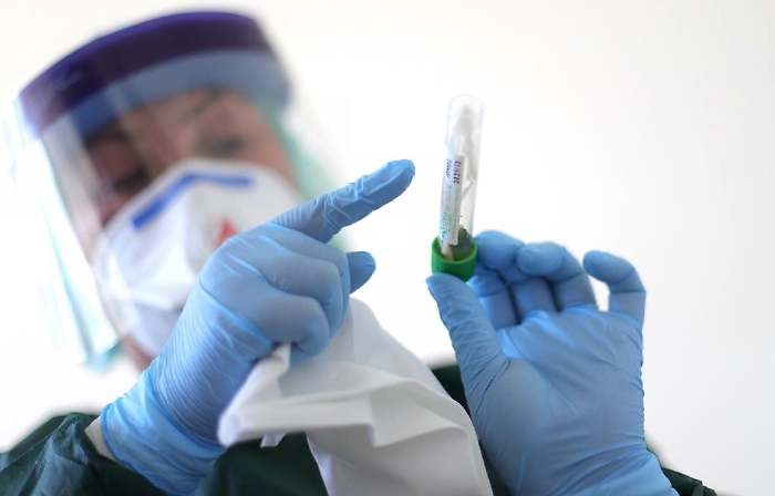 Coronavirus: focolaio ad Aci Catena, salgono a 9 i contagiati, 23 in isolamento