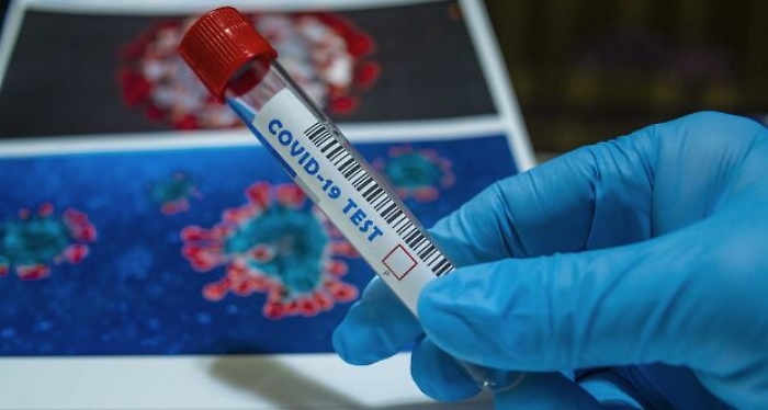 Palermo, giovane puerpera positiva al covid trasferita in ospedale