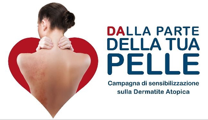 Dermatite atopica, visite gratuite sabato 26 settembre