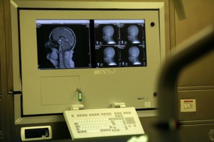 Ricerca: Cnr, 'forma' del cervello d&agrave; indizi su personalit&agrave; e disturbi mentali