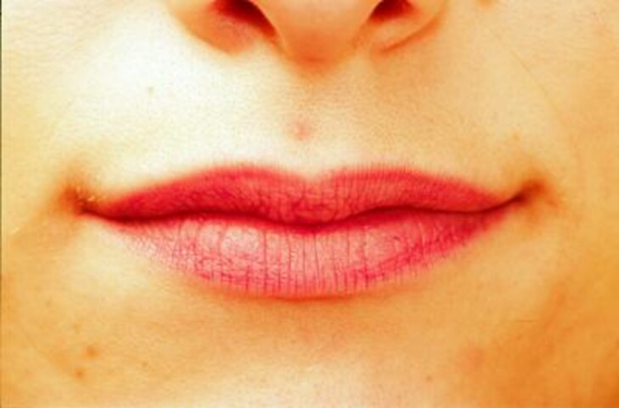 Bellezza: 'epidemia' di labbra a canotto, ecco tecniche per effetto naturale