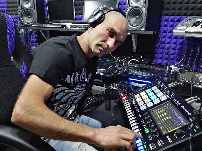 Un dj di Grammichele con la sua mano bionica fa ballare tutta l'Italia