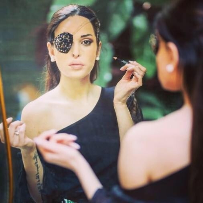 Jessica Notaro, su Fb a viso scoperto dopo l'intervento all'occhio