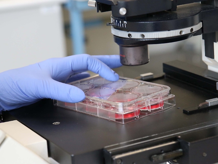 Analisi su tubercolosi