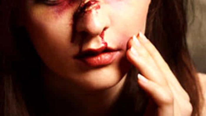 Sanguinante e in lacrime, donna fugge dal marito che l'aveva accoltellata